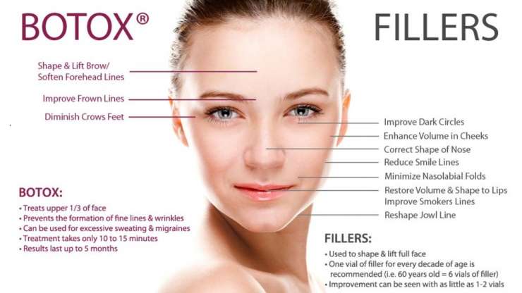 Recovery and Expectations After Botox and Dermal Fillers