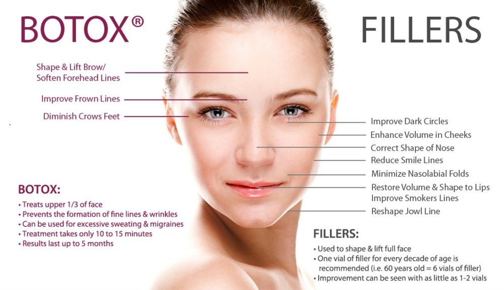 Recovery and Expectations After Botox and Dermal Fillers