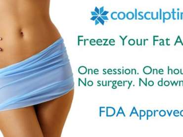 About Coolsculpting