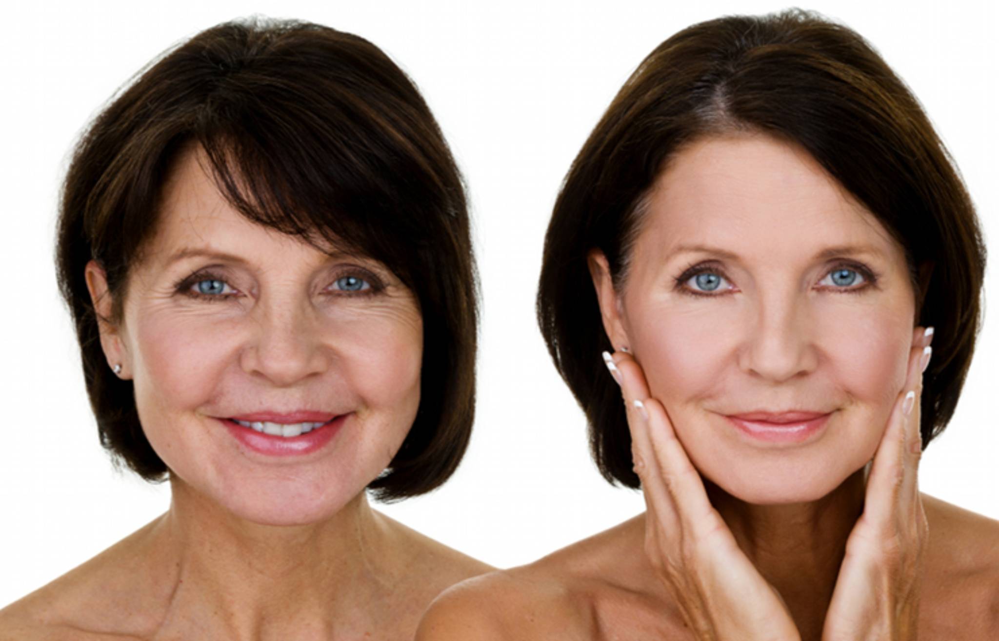 anti-aging-treatment-image (2)