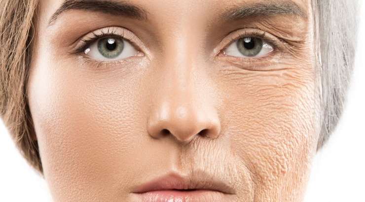 Can Lasers Get Rid of Wrinkles?