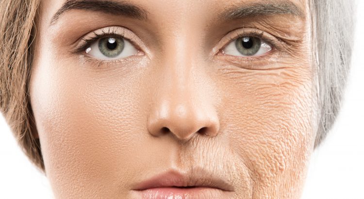 Can Lasers Get Rid of Wrinkles?