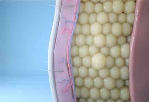 Fat cells before coolsculpting.