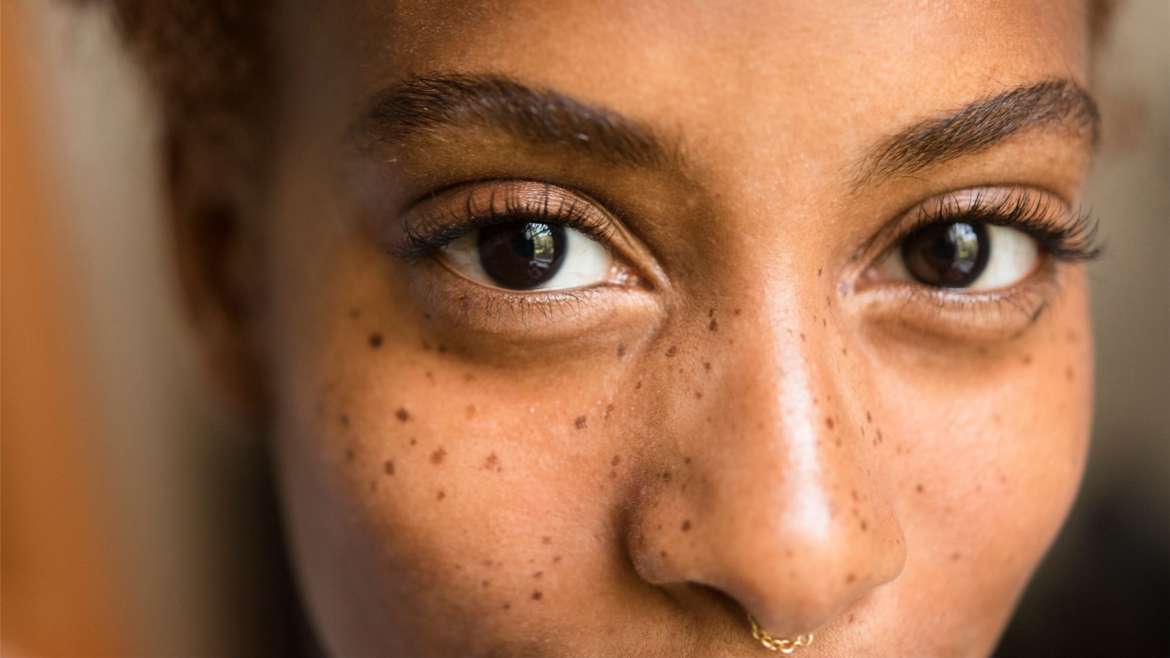 How do you lighten brown spots on your face?