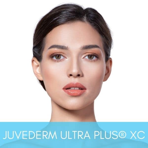 Woman with beautiful and natural looking results after Juvederm Ultra Plus XC injections at Sculpt DTLA.