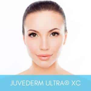 Woman with beautiful and natural looking results from Juvederm Ultra XC injections performed by expert injectors at Sculpt DTLA.