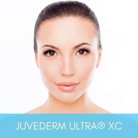 Woman with beautiful and natural looking results from Juvederm Ultra XC injections performed by expert injectors at Sculpt DTLA.