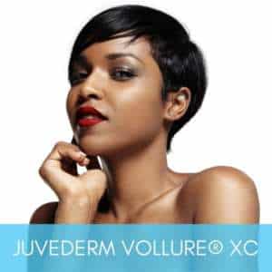 Woman modeling her natural looking results from Juvederm Vollure XC injections done at Sculpt DTLA with expert injectors.
